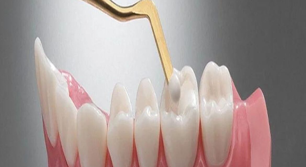 https://dev.relevantnepal.com/wp-content/uploads/2023/10/bramela-dentist-brampton-1170x640.jpg